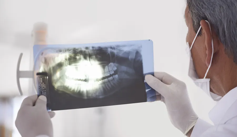Odontólogo analizando una radiografía panorámica