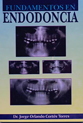 Cover of Fundamentos en Endodoncia