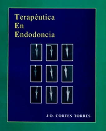 Cover of Terapéutica en Endodoncia